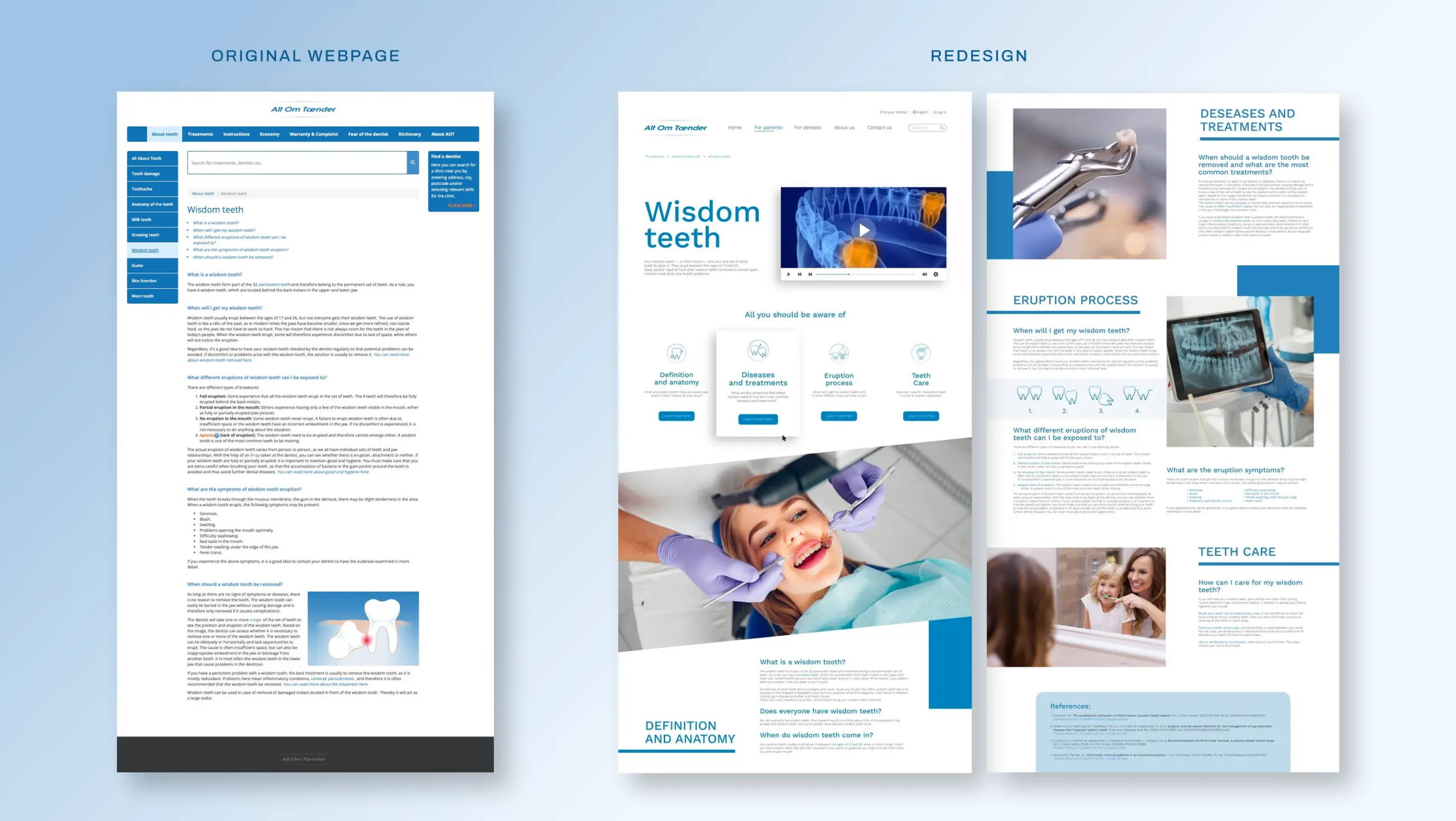 Alt om Tænder — original page beside the redesigned multi-section layout